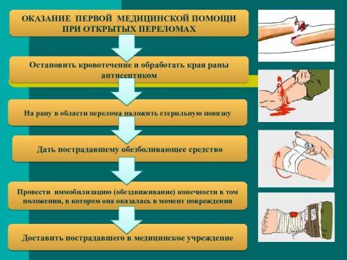 Упострадавшего-открытый перелом в области голени, артериальное кровотечение.в каком порядке следует