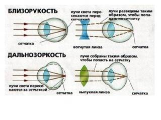 Охарактеризуйте недостатки зрения и их коррекции. билет по , 9 класс. , ; (