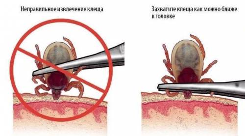 Опираясь на знания полученные в курсе обж напишите меры профилактики и первой медицинской при укусах