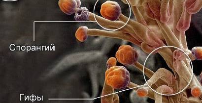 Строение плесневого гриба ! много умоляю найдите в интернете ну