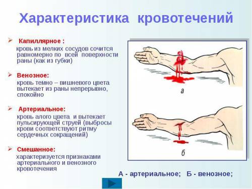 Дайте развёрнутый ответ: чем отличается артериальное кровотечение от венозного?