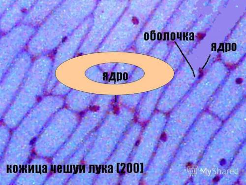 Сколько ядер в клетках чешуи лука, какую форму имеет ядро, где оно чаще всего наблюдается в клетках
