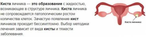 Киста - это образование: 1. полное, заполненное жидкостью; 2. полное, заполненное воздухом; 3. плотн