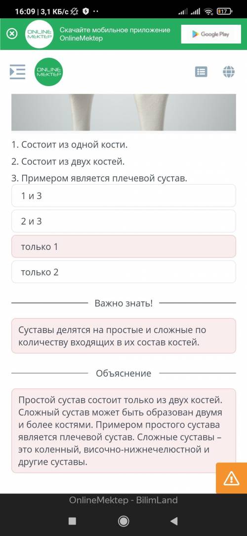 Главными компонентами сустава являются суставная головка и суставная образованные костями, входящими