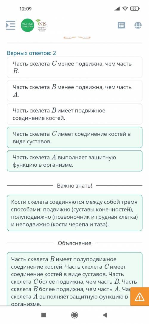 Строение скелета человека Используя рисунок, определи верные утверждения о строении скелета.Верных о