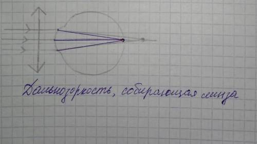 Какой недостаток зрения показан на рисунке? Нарисуйте необходимую линзу для исправления недостатка з