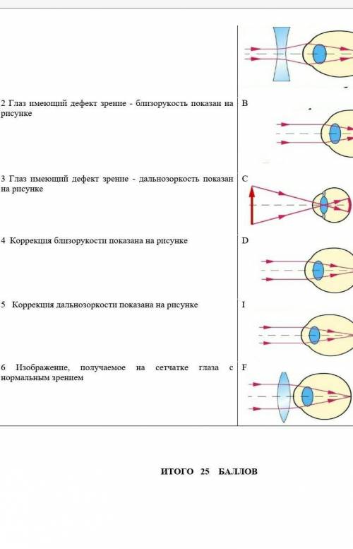 1) глаз имеющий нормальное зрение показан на рисунке ​