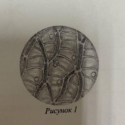 9 к какому классу относят растение, ткань которого показана на рисунке 1? 1) Папоротниковые 2) Хвойн