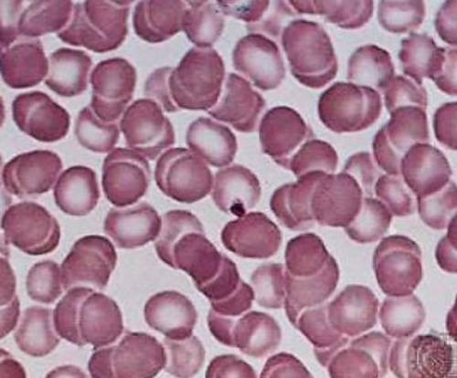 На микрофотографии представлены эритроциты – красные клетки крови человека. Рассчитайте увеличение р
