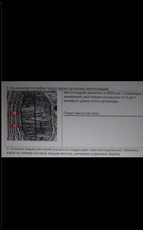 2. На микрофотографии представлен органоид- митохондрий. Митохондрий увеличен в 5000 раз. С измерени