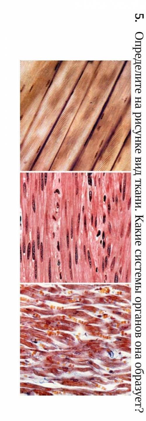 Определите на рисунке вид ткани. Какие системы органов она образует​