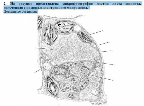 за правильный ответ На рисунке представлена ​​микрофотография клетки листа шпината, полученная с эле