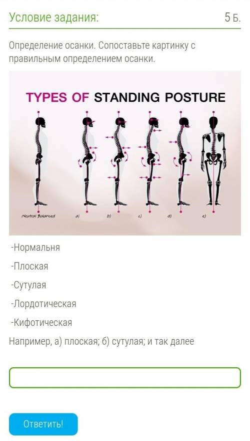 Определение осанки. Сопоставьте картинку с правильным определением осанки