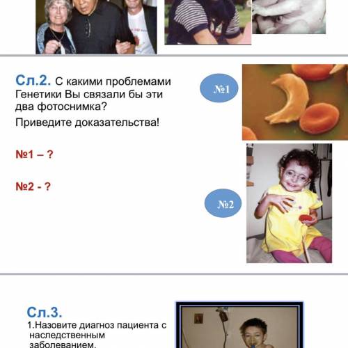 Сл.2. С какими проблемами Генетики Вы связали бы эти два фотоснимка? Приведите доказательства!