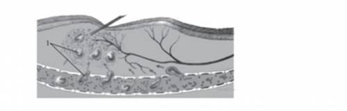 Рассмотрите схему воспалительного процесса. Что на ней обозначено под цифрой 1? 1. кровеносные сосуд