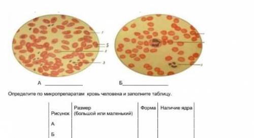 Криминалисту необходимо выяснить, какой из образцов крови принадлежит человеку