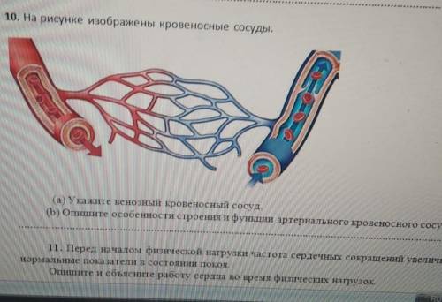 на рисунке изображены кровеносные сосуды.(а:Укажите венозный кровенистый сосуд,(б:Опишите особенност