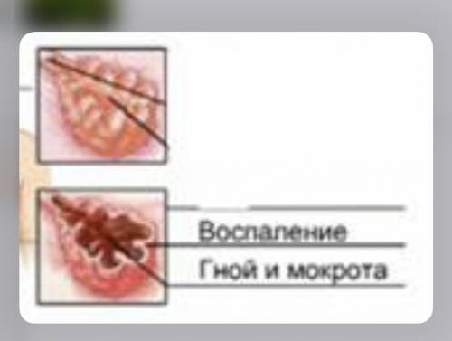 Назовите, какая часть дыхательного аппарата изображена на рисунке. 1. Бронх 2. Трахея 3. Альвеола 4.