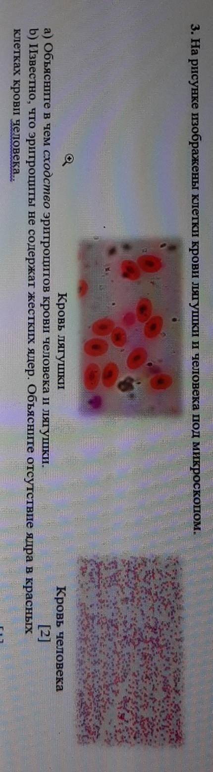 3. На рисунке изображены клетки крови лягушки и человека под микроскопом. 0Кровь лягушкиКровь челове