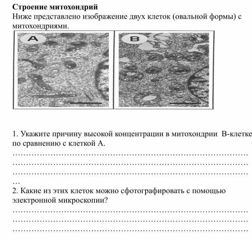 с ПЕРВЫМ ВОПРОСОМ И ВТОРЫМ Какие из этих клеток можно сфотографировать с электронной микроскопии ?