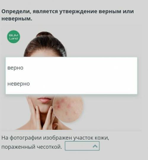 Определи, является утверждение верным или неверным. ￼На фотографии изображен участок кожи, пораженны