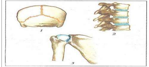 (b) опишите соединение костей в суставе 2 по ряду признаков: по числу костей - по форме суставных по