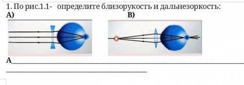 По рис.1.1- определите близорукость и дальнезоркость: А) В) А