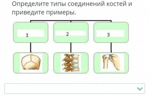 1 подвижное 2 полуподвижное 3 неподвижное 2) 1 неподвижное 2 полуподвижное 3 подвижное 3) 1 неподвиж