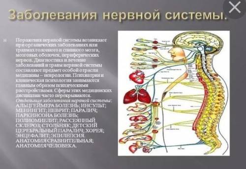 Напишите сообщение о заболевании нервной системы .​