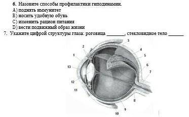 Назовите профилактики гиподинамии. A) поднять иммунитетB) носить удобную обувьC) изменить рацион пит