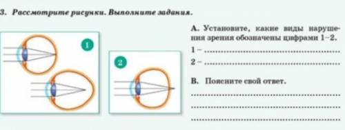 Рассмотрите рисунок.Выполните задания. А) Установите, какие виды нарушения зрения обрзнечены цифрами