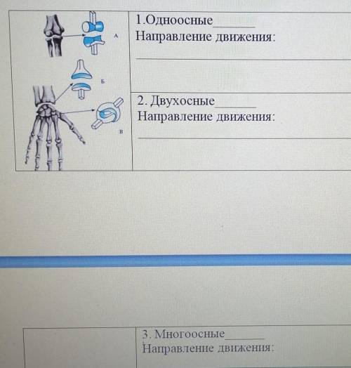 . Рассмотрите рисунок. Какие суставы являются одноосными, двухосными, многоосными? Укажите,направлен