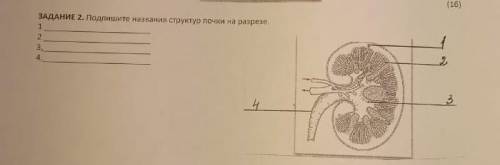 Подпишите названия структур почки на разрезе ​