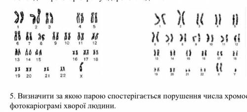 Визначити за якою парою ігається порушення числа хромосом на фотокаріограмі хворої людини.