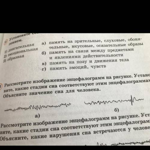 (14) Рассмотрите изображение энцефалограмм на рисунке. Устано- вите, какие стадии сна соответствуют 