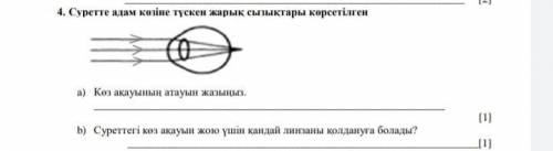 На картинке показаны линии света, падающие на человеческий глаз. Напишите название дефекта глаза. Ка