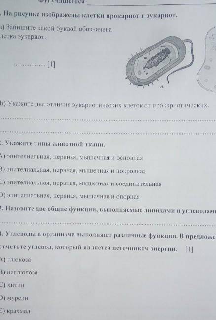 На рисунке изображены клетки прокарнот и зукарнот. (а) Запишите какой буквой обозначена клетка эукар