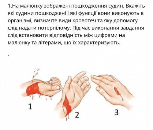 A) кров рухається до серця, б) швидкість руху крові найменша, в) венозна кровотеча, г) ш судини за