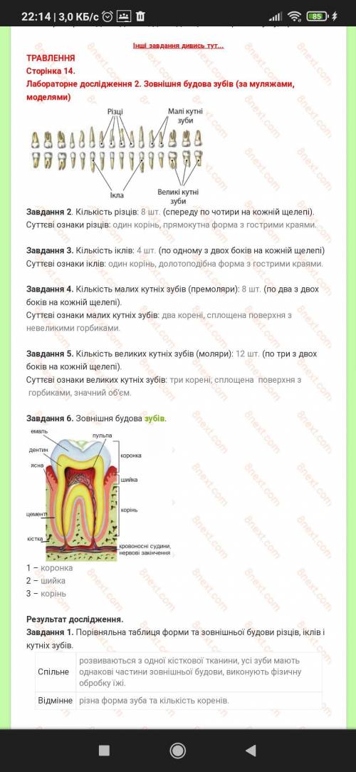 Лабораторне дослідження № 5 Тема: Зовнішня будова зубів (за муляжами, моделями) Огаднання: модель бу