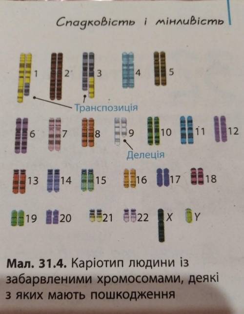 8*. Зробіть хромосомний аналіз каріотипу, який зображено на мал. 31.4, і визначте, які порушення маю