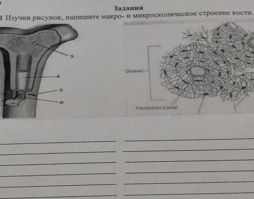 Изучив рисунок, напишите макро - и микроскопическое строение кости