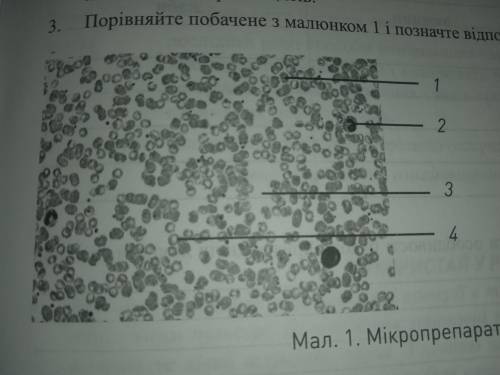 До іть будь ласка.  порівняти із малюнком і позначити відповідними цифрами складові крові