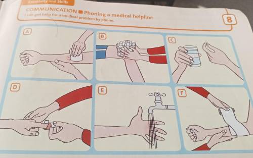 1 Match instructions 1-6 with pictures A-F. 1 Put some ice on it. 2 Put it under cold water. 3 Clean